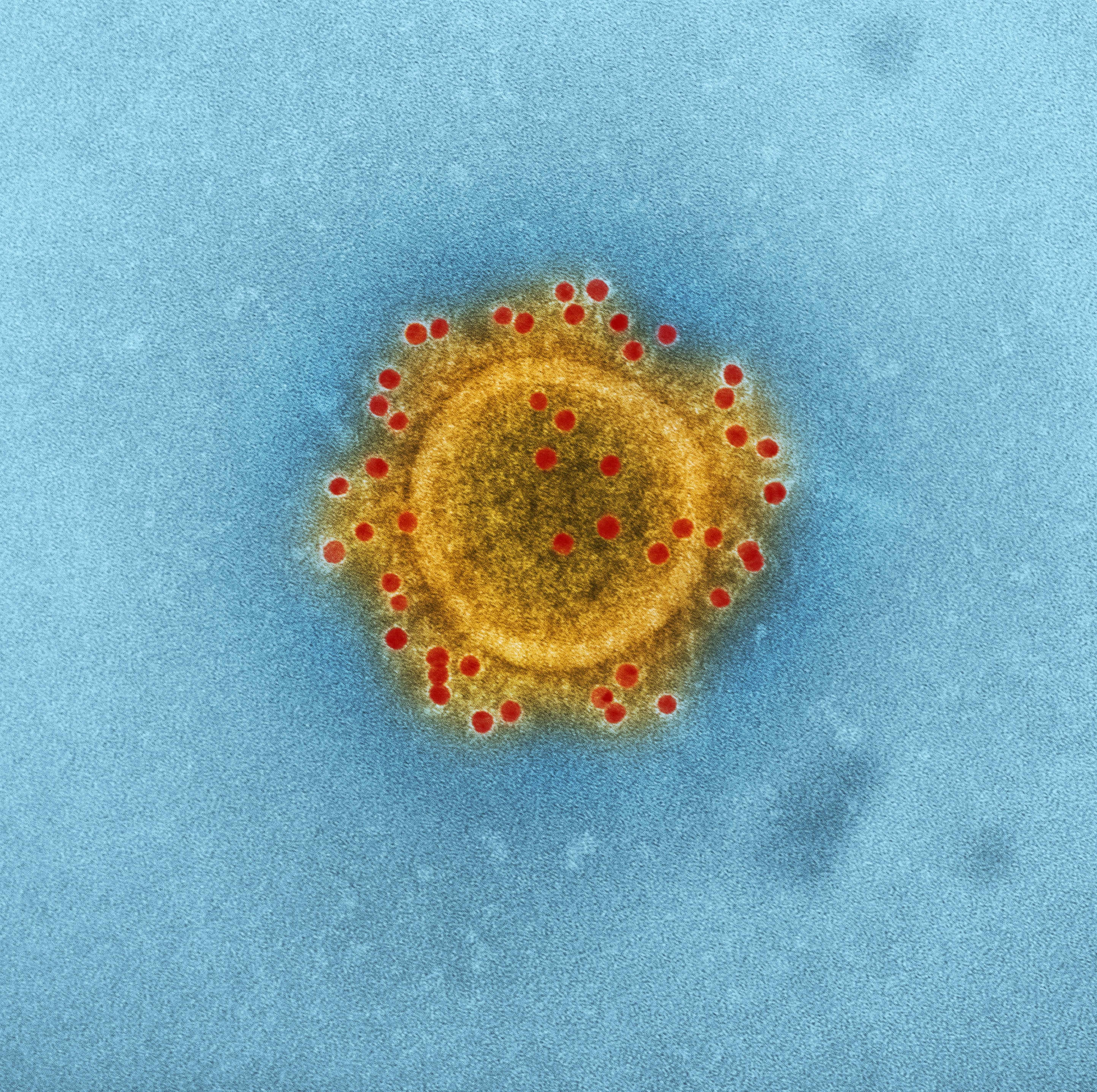 Imagem microsc&oacute;pica do coronav&iacute;rus MERS-COV, produzida pelo Instituto Nacional de Doen&ccedil;as Infecciosas e Al&eacute;rgicas - CDC/Unsplash
