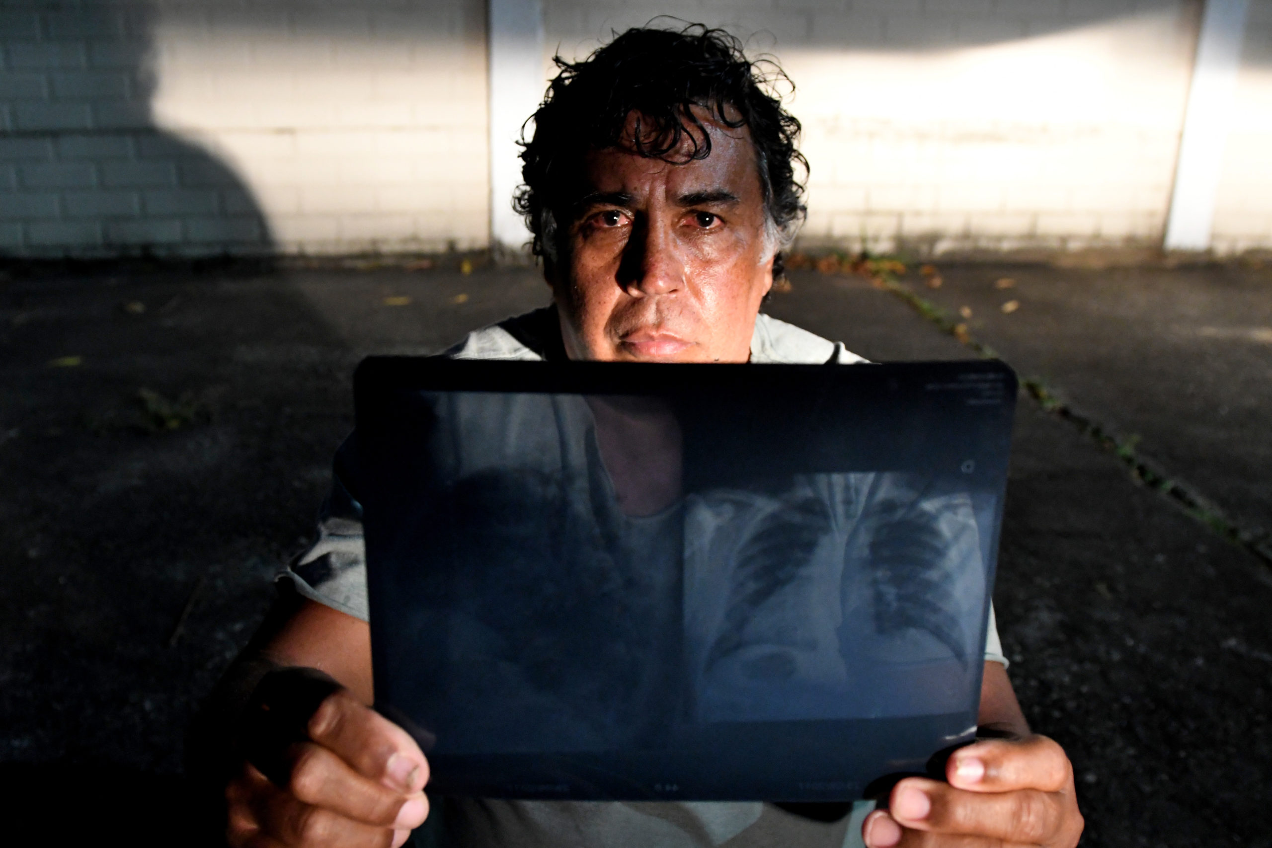 polido com sangue como o marmore e o granito produzidos no espirito santo vao para o exterior a custa de vidas de trabalhadores img20 scaled 1
